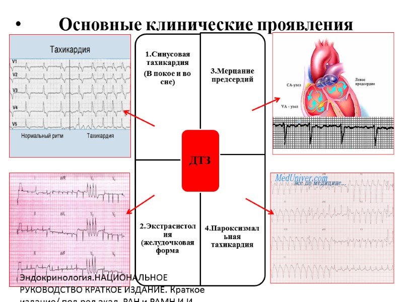 Основные клинические проявления Эндокринология.НАЦИОНАЛЬНОЕ РУКОВОДСТВО КРАТКОЕ ИЗДАНИЕ. Краткое издание/ под.ред акад. РАН и РАМН